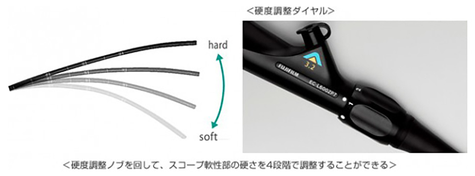 下部消化管内視鏡検査（大腸ファイバー）の方法について