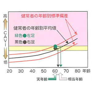 ABI（足関節上腕血圧比）